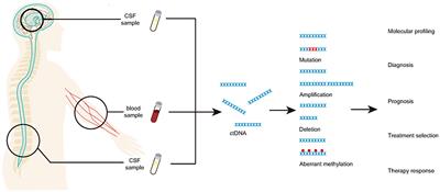 Recent Advances in Liquid Biopsy of Brain Cancers